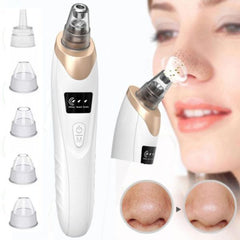 Image of 5-in-1 Electric Blackhead Remover Acne Treatment and Facial Pore Cleaner.