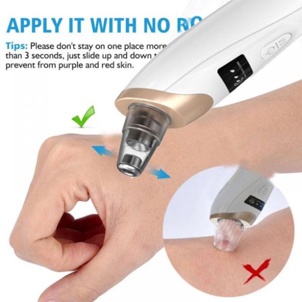 Image of 5-in-1 Electric Blackhead Remover Acne Treatment and Facial Pore Cleaner.