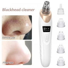 Image of 5-in-1 Electric Blackhead Remover Acne Treatment and Facial Pore Cleaner.